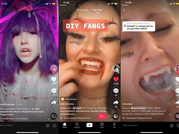 crazy tiktok users gluing vampire fangs to their teeth